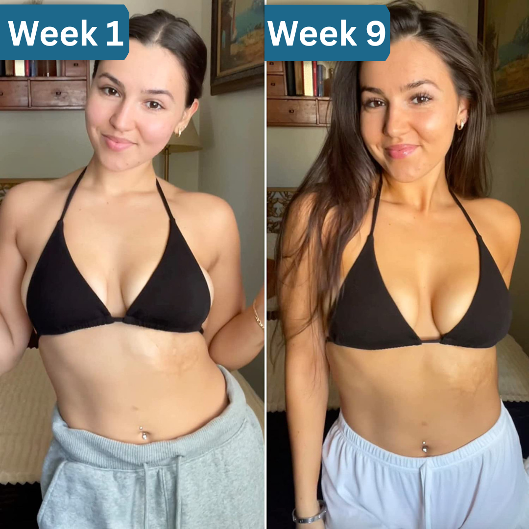 GlowBites - Tanning Gummy | Anti-Aging Supplement